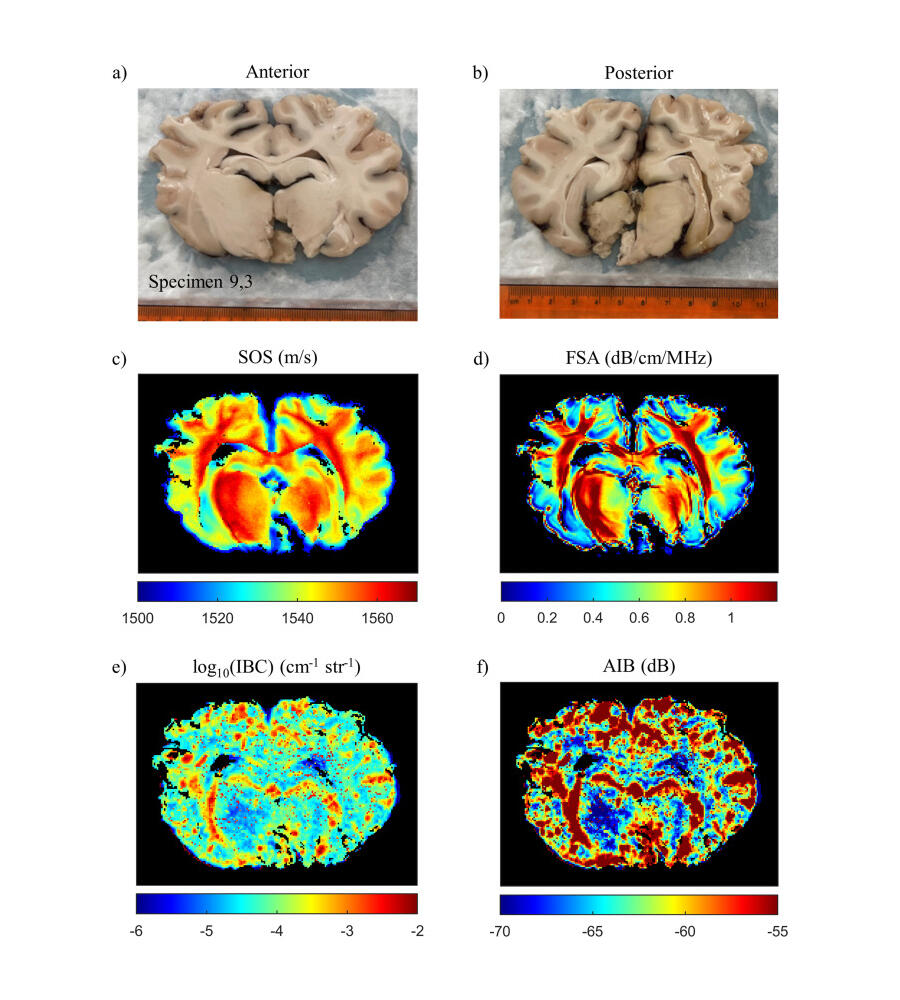 Images of the brain
